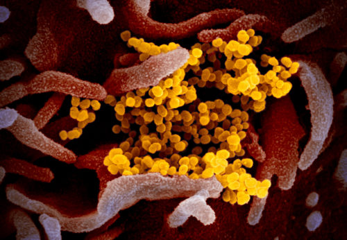 Image of SARS-CoV-2, the virus that causes COVID-19