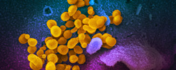 This scanning electron microscope image shows SARS-CoV-2 (yellow)—also known as 2019-nCoV, the virus that causes COVID-19—isolated from a patient in the U.S., emerging from the surface of cells (blue/pink) cultured in the lab. Credit: NIAID-RML