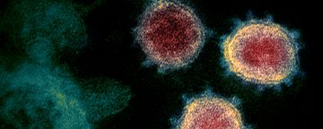 Novel coronavirus image from NIAID