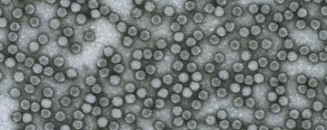 Microscopic view of the poliovirus.