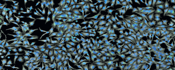 Image of HeLa cells. Credit: NIH/Tom Deerinck, National Center for Microscopy and Imaging Research.