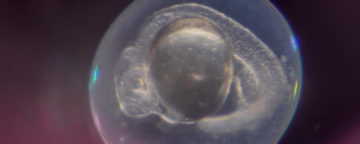 Zebrafish embryo. Credit: NICHD/B. Feldman, J. Swan.