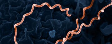 Colorized electron micrograph of Treponema pallidum, the bacteria that cause syphilis.